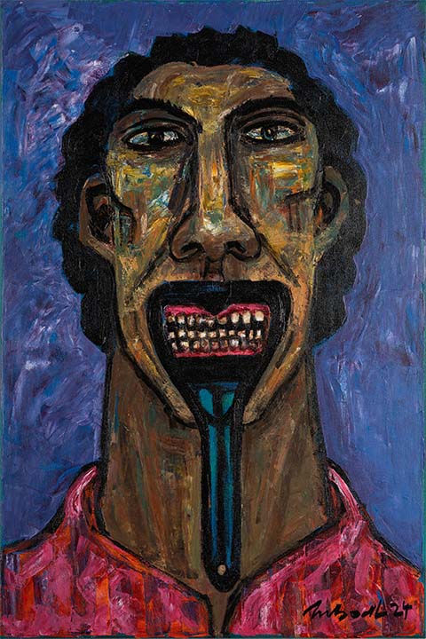 Mouth Opener