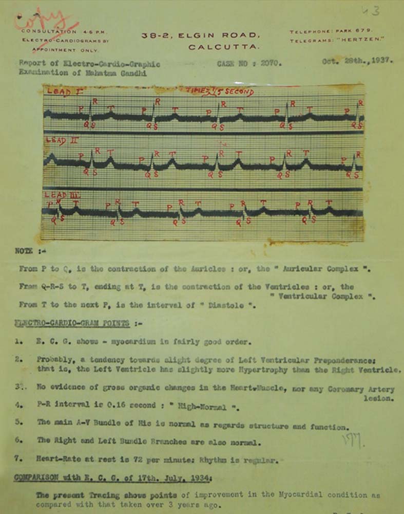 Gandhi’s Heart Sounds