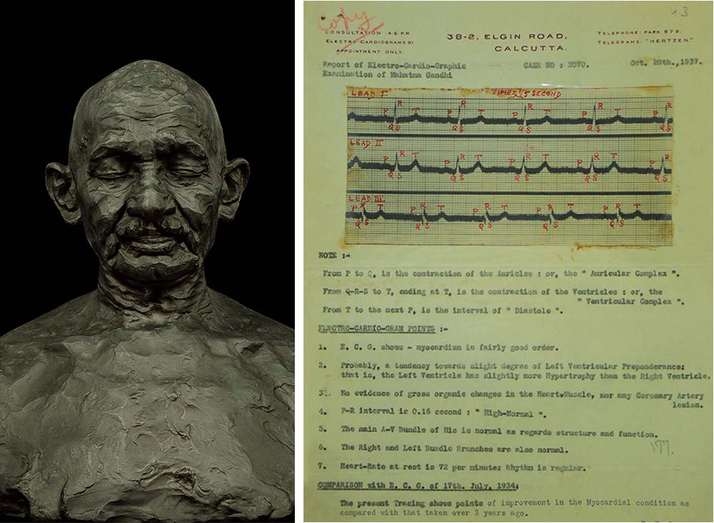 Gandhi’s Heart Sounds